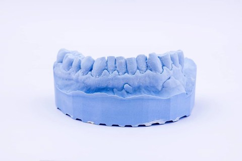Denture impression of an upper jaw for dentures, dentist, dental impression