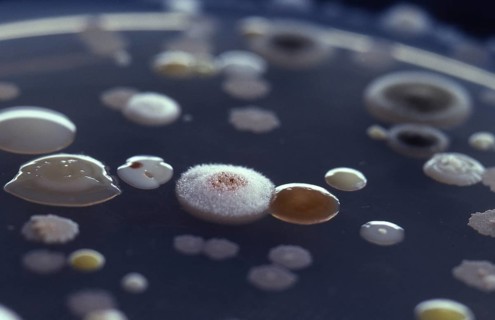 Bacteria and moulds growing on agar in a petri dish
