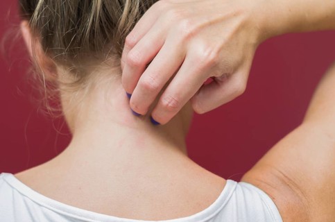 Great concept of allergy and skin diseases, young woman scratching herself