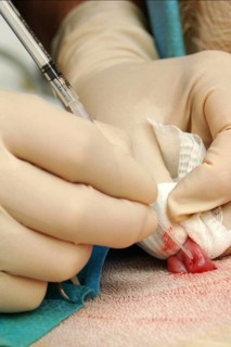 Vets implant an embryo into the uterus of a surrogate hind during an embryo transfer programme on