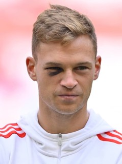 Joshua Kimmich FC Bayern Munich FCB (06) black eye, violets, Allianz Arena, Munich, Bavaria,