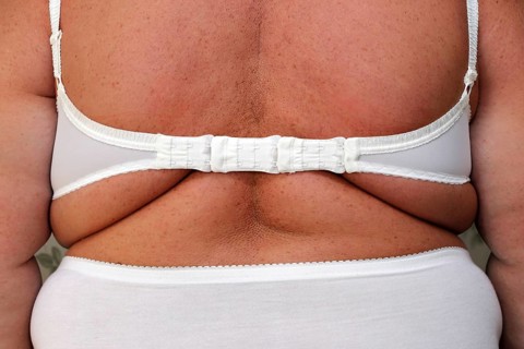 Back of obese overweight women in underwear close-up