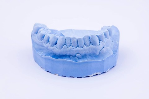 Denture impression of an upper jaw for dentures, dentist, dental impression