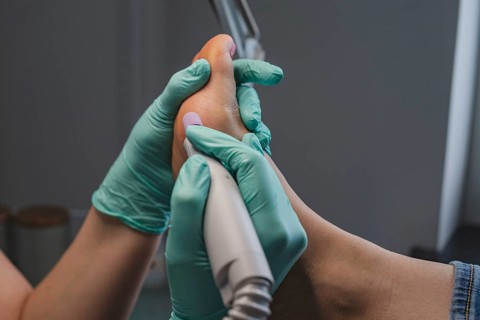 Podiatric foot treatment, milling of the epidermis with a tool. A close-up of the treatment. Close
