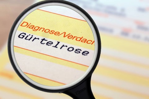 Symbolic image: Shingles diagnosis on a doctor's referral. Shingles often occurs after coronavirus