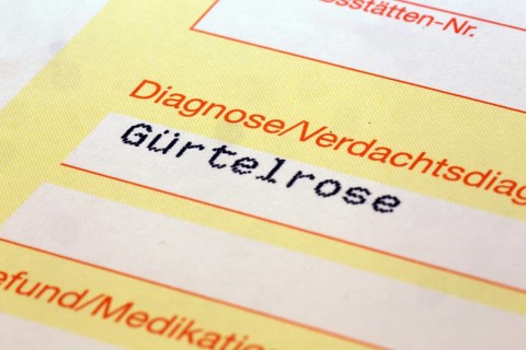 Symbolic image: Shingles diagnosis on a doctor's referral. Shingles often occurs after coronavirus