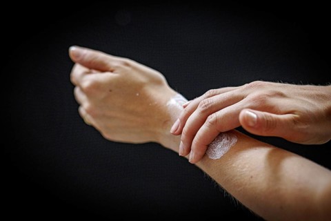 A person rubs a cream on her arm in Berlin, 09/08/2024