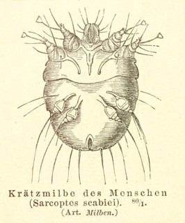 Historical wood engraving, illustration from Meyers encyclopedia 4th edition 1889 and 1890, scabies