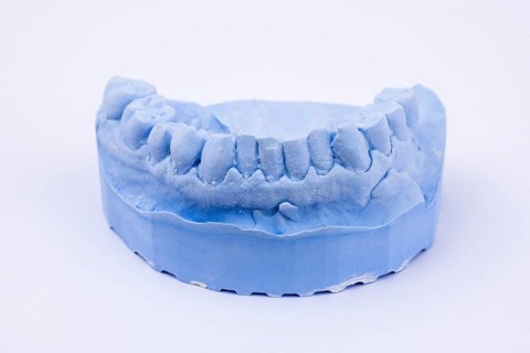 Denture impression of an upper jaw for dentures, dentist, dental impression