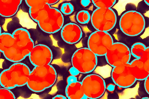 Shape of bacterial cell: cocci, bacilli, spirilla bacteria background