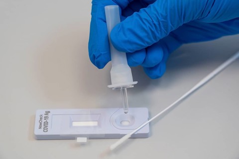 Covid-19 rapid test, antigen test, the abrasion of the swab is dissolved in a liquid and applied to