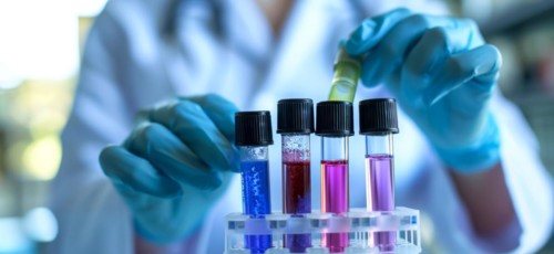 Scientist in lab medicine research holding vials with blood and virus samples for DNA sequencing,