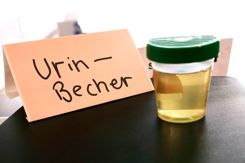 A cup with urine, urine sample, urine cup, doctor's surgery, examination, health