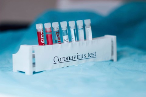 Test tubes labeled for coronavirus testing placed in a holder on a blue surface