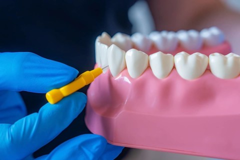 Dental model shows interdental cleaning with a yellow tool, dental practice, Germany, Europe