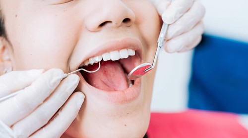 Hands of a specialist dentist cleaning the teeth of a female patient. Close up of dentist hands