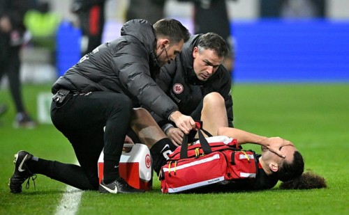Arthur Theate Eintracht Frankfurt SGE (03) injured Injury on the ground Coach Voith-Arena,