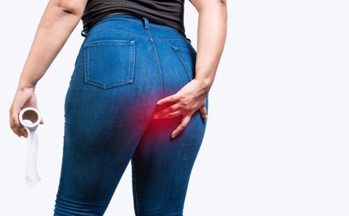 Girl with digestive problem touching buttock isolated holding toilet paper. Woman with diarrhea