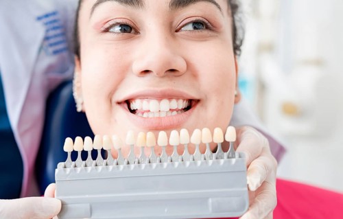 Dentist holding a set of implants with various shades of tone. Patient selecting the shade of