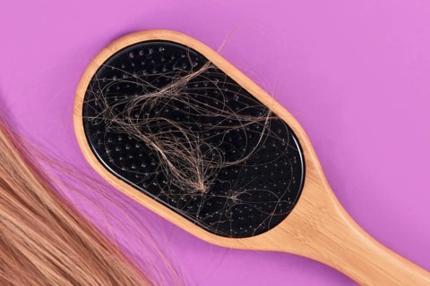 Concept for losing hair with strands of blond hair caught in hair brush