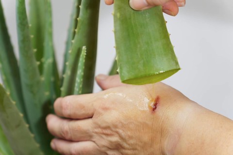 Close-up of a woman applying fresh aloe vera to a wound on her hand