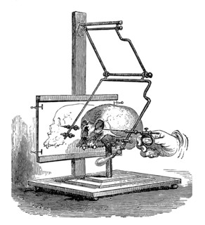 Stereograph designed by Pierre Paul Broca and manufactured by Mathieu