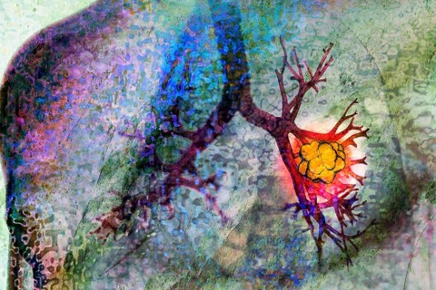 Tumour in a lung, Illustration Medicine and Health