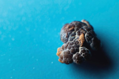 Kidney stone, intact, formed in an alkaline environment in the kidneys after ESWL intervention or