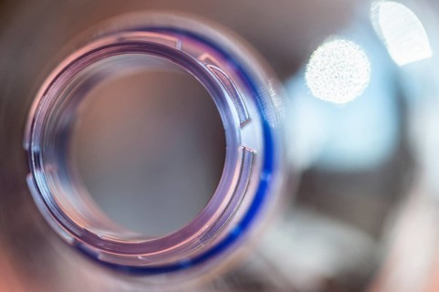 Close-up of the opening of a plastic bottle