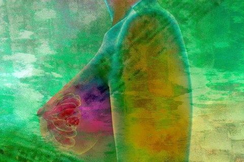Tumour in a female breast, illustration medicine and health