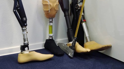 Modern prosthetic legs for people with ampute