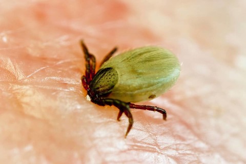 Tick bitten into human skin, common Castor Bean Tick (Ixodes ricinus), tick bite