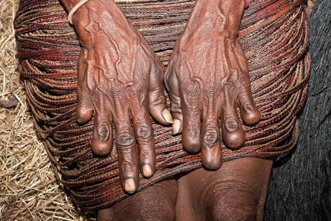 Hands of Dani woman, amputated finger, tradition on death of close relative, Baliem Valley, West