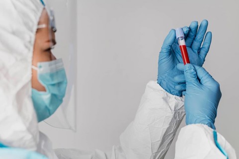 Side view doctor holding blood sample