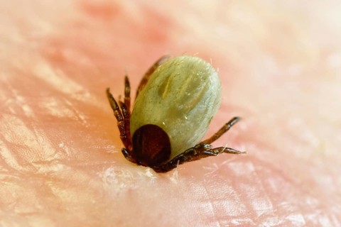 Tick bitten into human skin, common Castor Bean Tick (Ixodes ricinus), tick bite