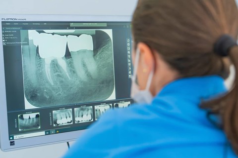 Dentist analysing X-ray images of teeth on a computer screen, dental practice, Germany, Europe