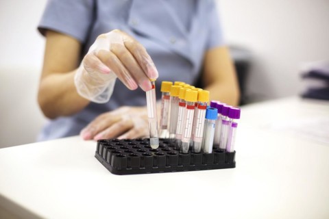 Female doctor holding Blood test tubes in hands. Close up