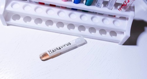 Test tube labeled Hantavirus placed near a rack in a lab setting