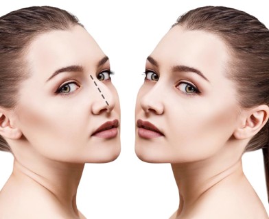 Female face before and after cosmetic nose surgery over white background