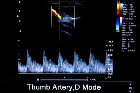 Colourful image of modern ultrasound monitor. Ultrasonography machine. High technology medical and