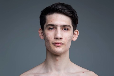 Studio portrait of a young brunette caucasian man on grey background posing. Puberty theme, problem