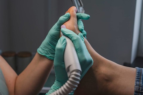 Podiatric foot treatment, milling of the epidermis with a tool. A close-up of the treatment. Close