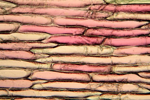 Onion cells under the microscope