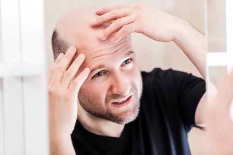 Male alopecia or hair loss concept, adult caucasian bald man looking mirror for head baldness
