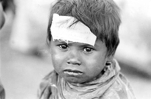 Sick child, union carbide gas leak tragedy, Bhopal, madhya pradesh, India, Asia