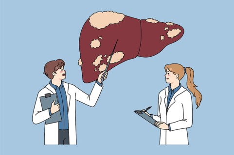 Diverse doctors in medical uniforms examine sick patient liver. Therapist make ultrasound body