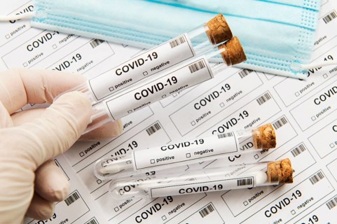 Many covid-19 test tubes for lots of testing