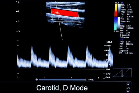 Colourful image of modern ultrasound monitor. Ultrasonography machine. High technology medical and