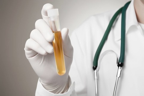 Doctor holding a bottle of urine sample
