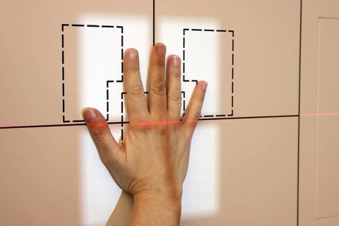 X-ray of one hand